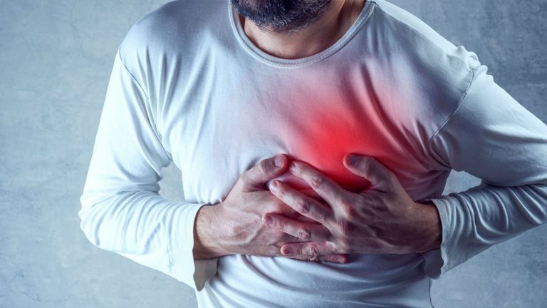 heart attack