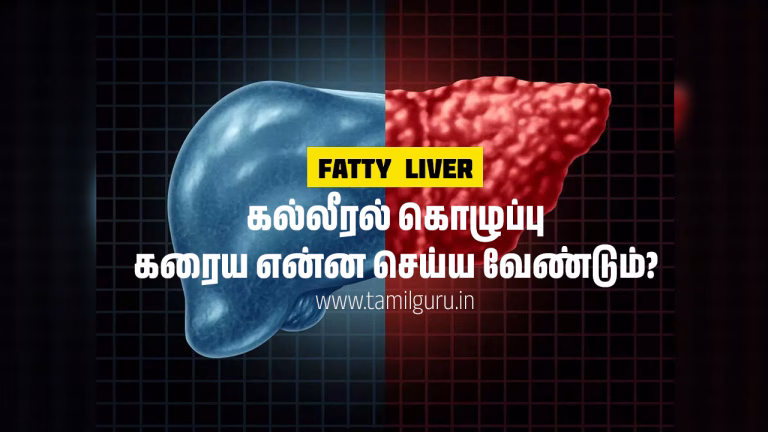 Ultimate Natural Ways to Reduce Fatty Liver